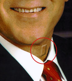 Politician equipped with the discreet, effective Laryngeal Bleep Implant