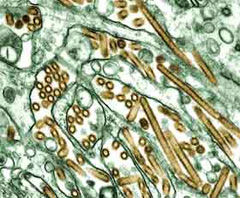 H5N1 avian flu virus strains (gold) prior to latest tweak by Hand of God: Photograph by C. Goldsmith/U.S. Centers for Disease Control